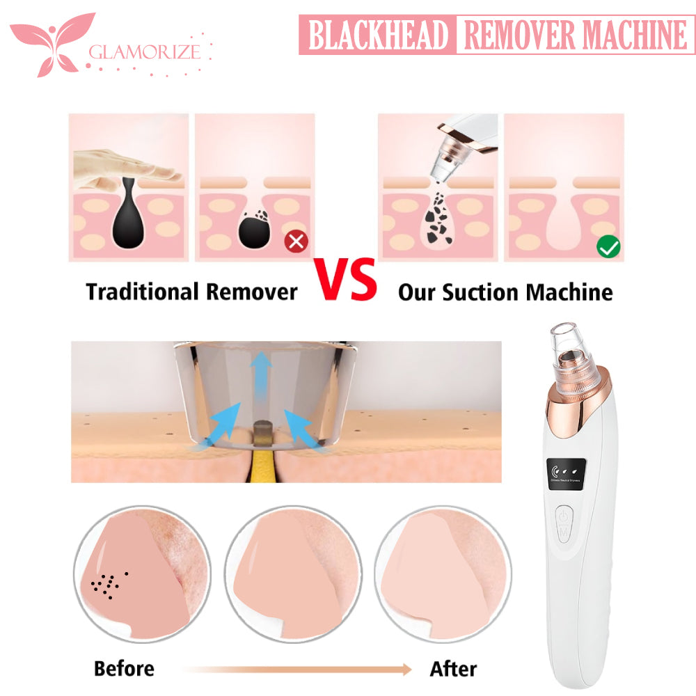 4 in 1 Black Head Remover