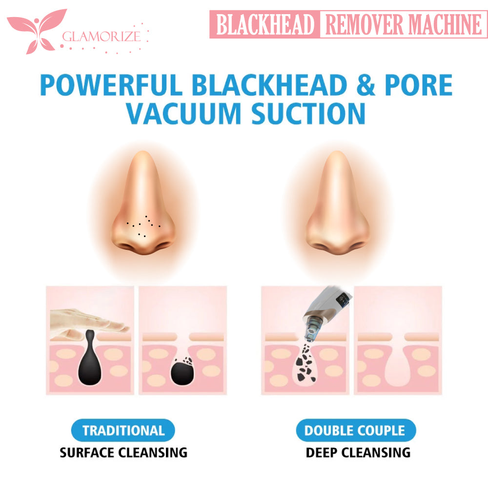 4 in 1 Black Head Remover